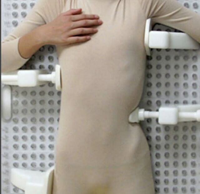 Patient on Providence Nocturnal Scoliosis® System Board