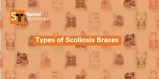 2025 Scoliosis Blog Cover Template 1200x600 1