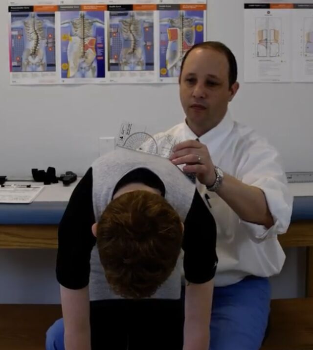 Adams Forward Bend scoli