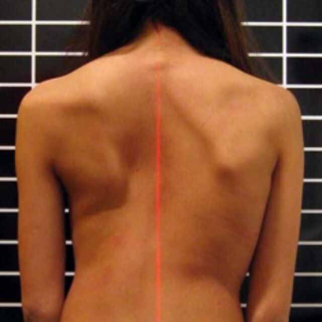 Picture1