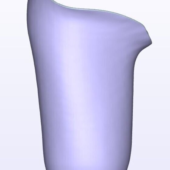 Mild IC Anterior