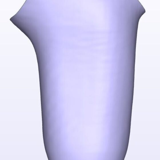 Mild IC Lateral