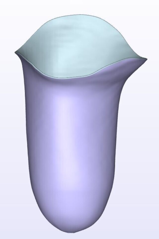 Mild IC Medial