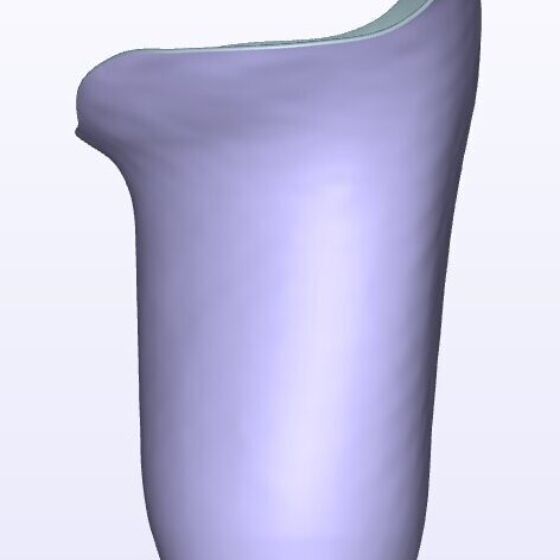 Mild IC Posterior