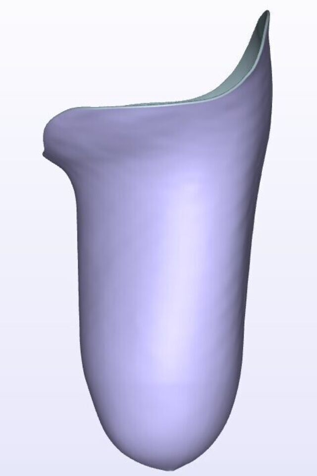 Mild IC Posterior