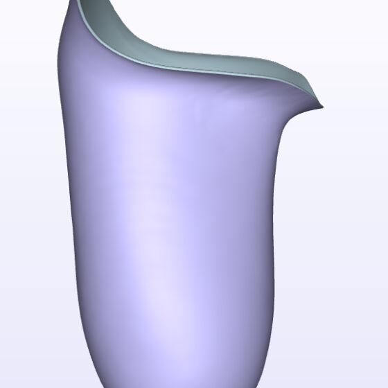 Moderate IC Anterior