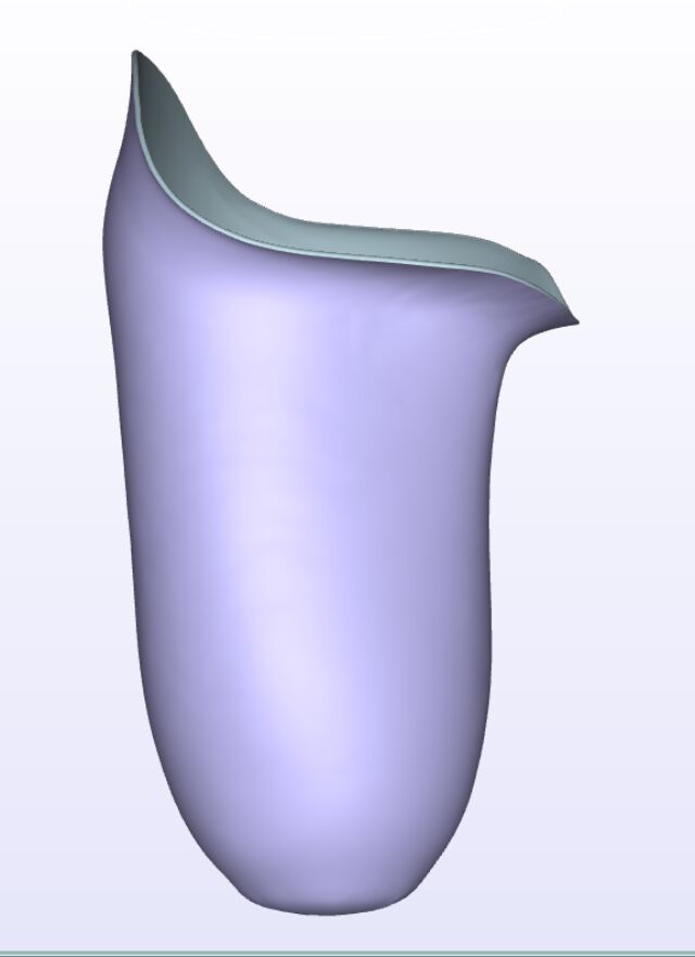 Moderate IC Anterior