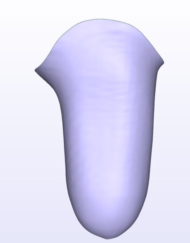 Moderate IC Lateral brochure