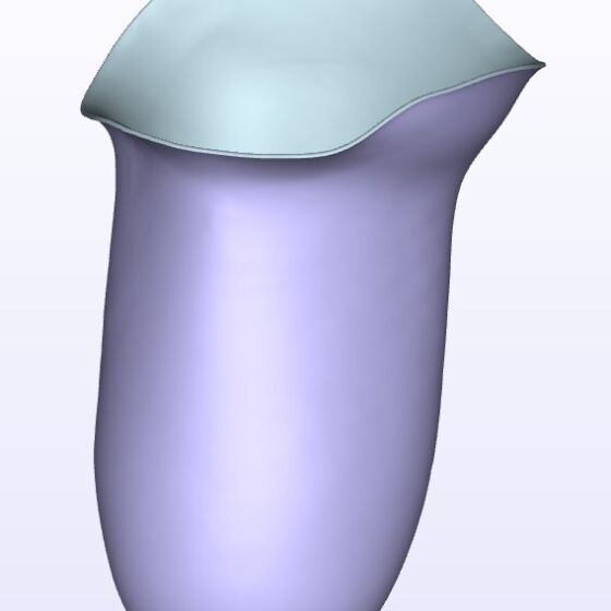 Moderate IC Medial