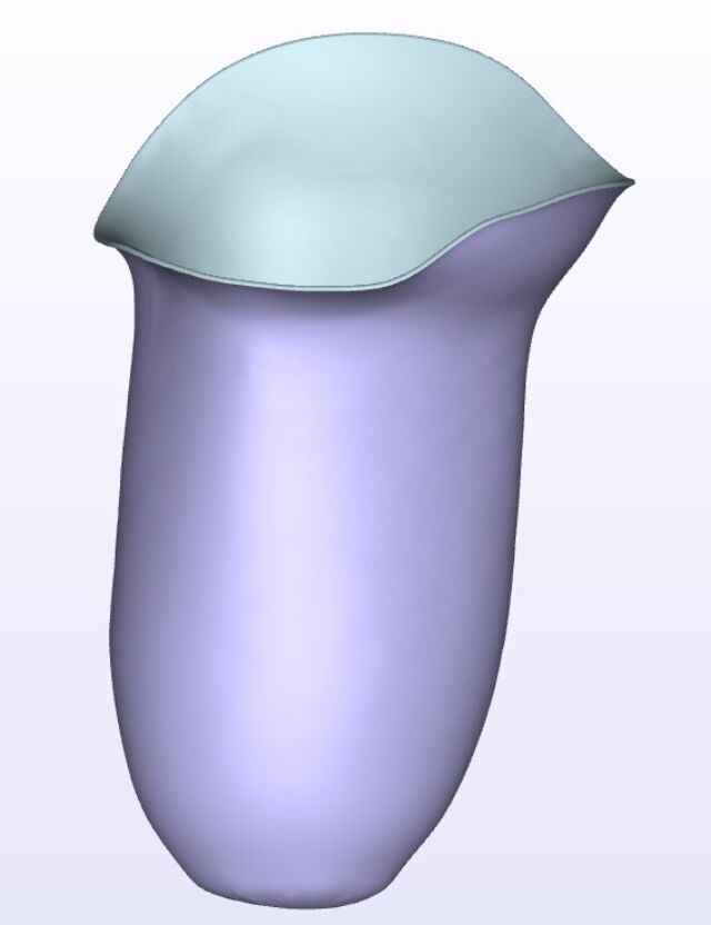 Moderate IC Medial