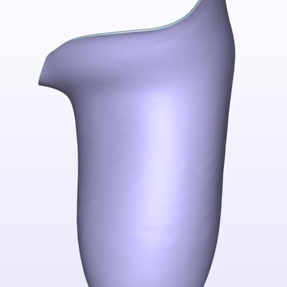 Moderate IC Posterior