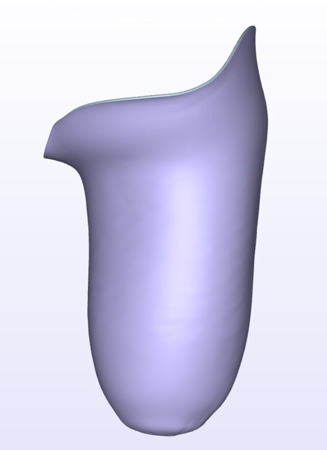 Moderate IC Posterior