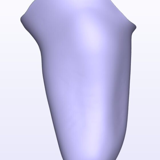 Agessive IC Lateral