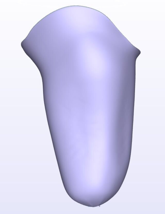 Agessive IC Lateral