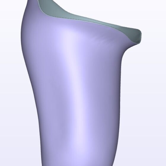 Agressive IC Anterior