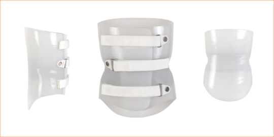 Anterior Overlap Orthosis SEO Image