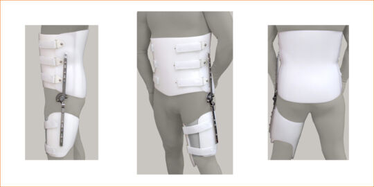 HIP Bivalve with Hip Joint and Thigh Cuff Orthosis SEO Image