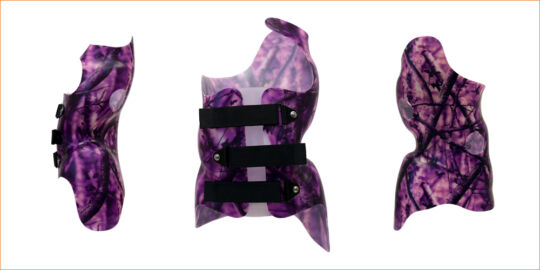 SCT 3D Chêneau Style Scoliosis Orthosis SEO Image