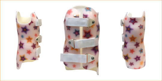 SCT 3D Wilmington Scoliosis Orthosis SEO Image