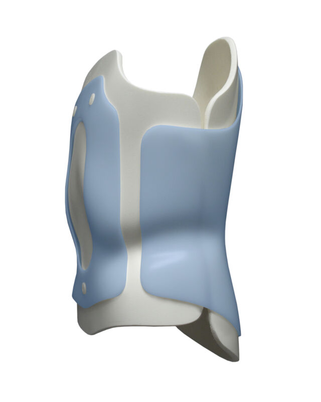 Anterior into posterior trim foam