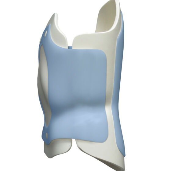 Anterior over posterior trim foam