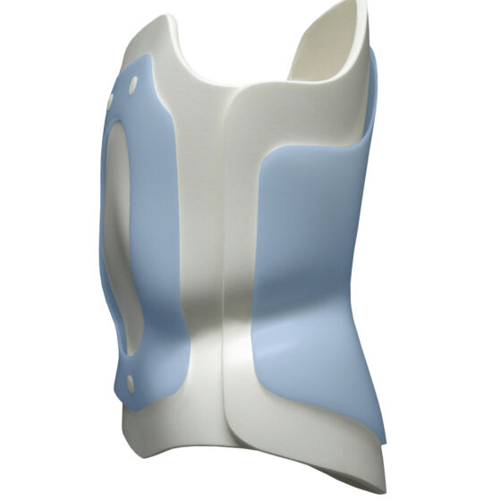 Anterior into posterior foam overlapping foam