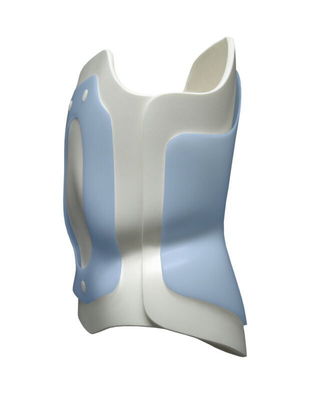 Anterior into posterior foam overlapping foam