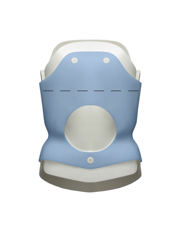 Small Abdominal Cut-Out Allows Anterior Conversion to LSO
