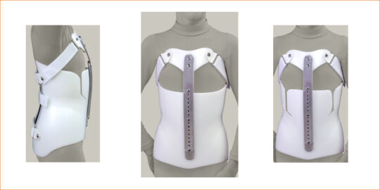 Kyphosis SEO Image