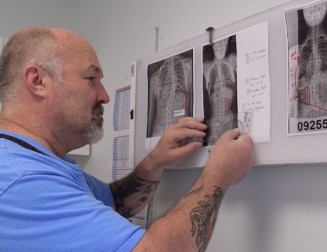 Clinical X-Ray evaluation defines patient brace design