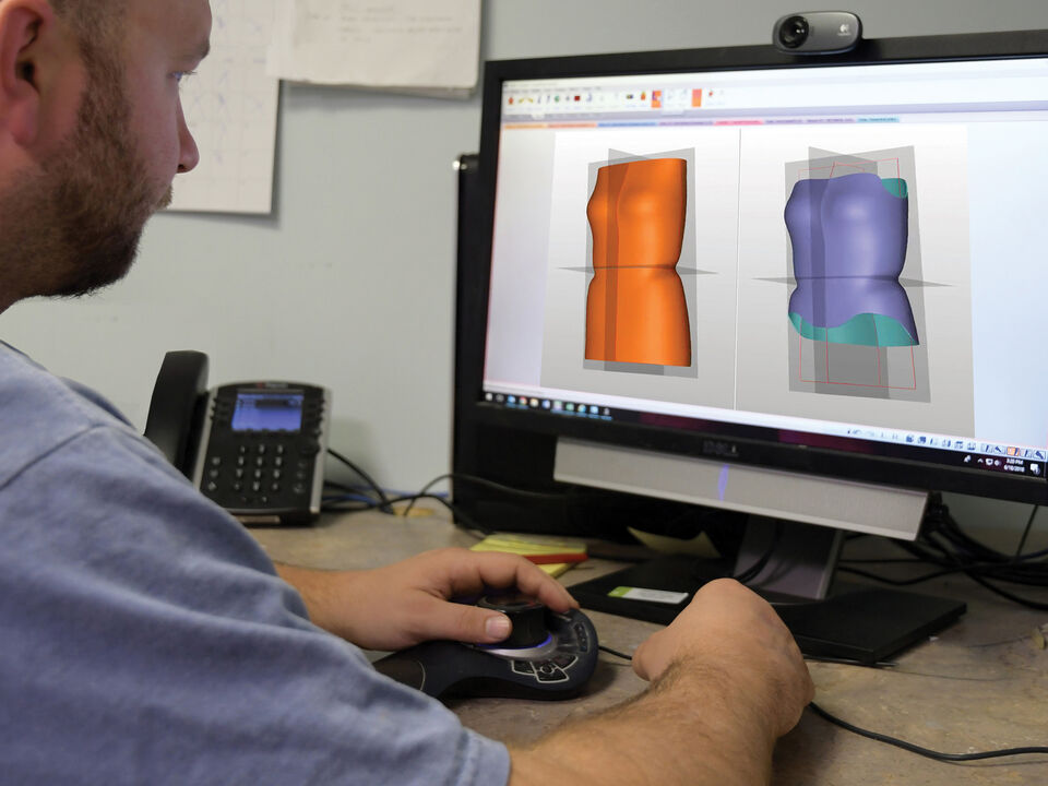 Advanced 3D technology to achieve precise custom fit for the best patient outcome
