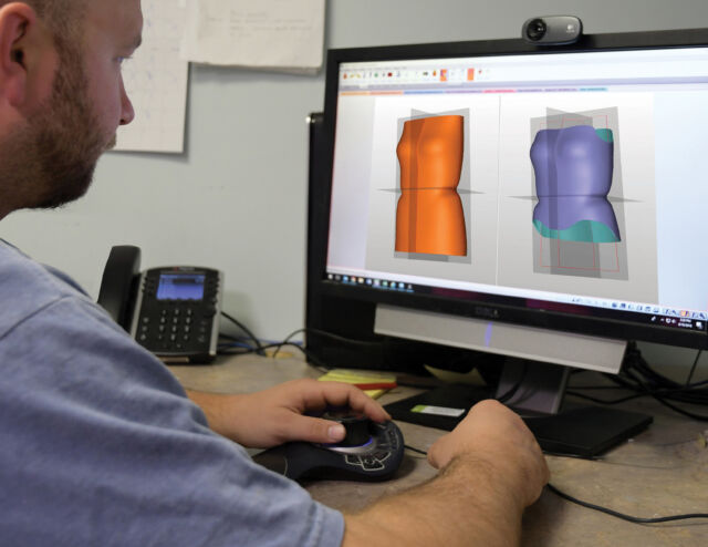 Advanced 3D technology to achieve precise custom fit for the best patient outcome