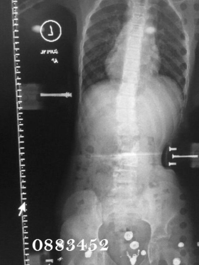 Providence X-Ray Set 1 on Board