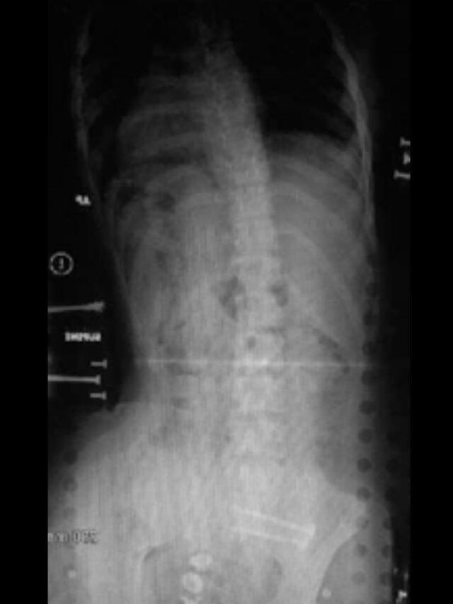 Providence X-Ray Set 2 on Board