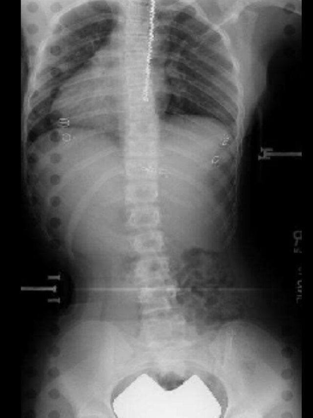 Providence X-Ray Set 3 on Board
