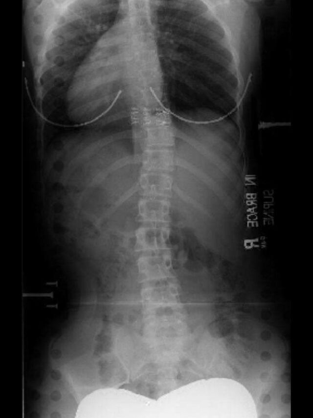 Providence X-Ray Set 4 on Board