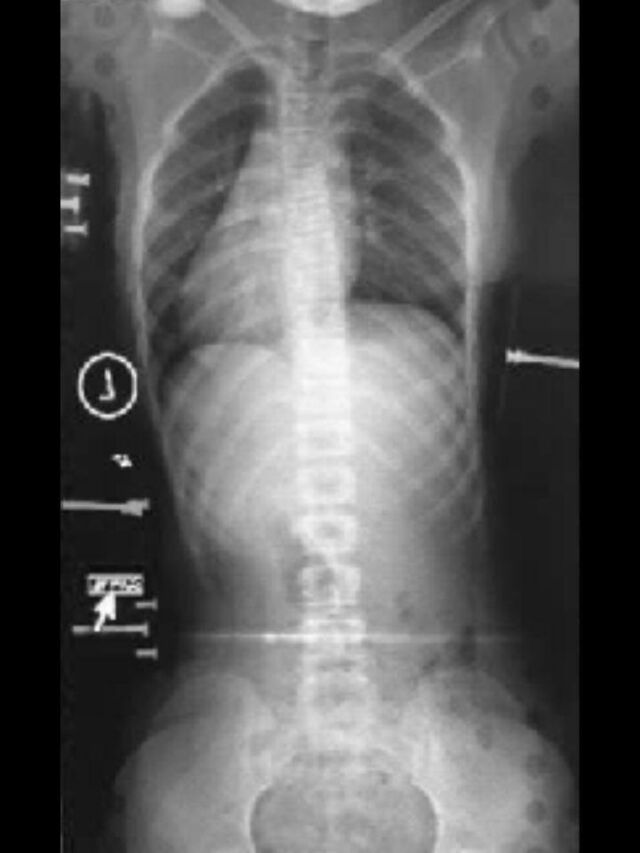 Providence X-Ray Set 5 on Board