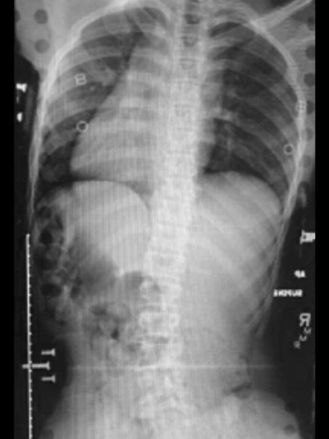 Providence X-Ray Set 6 on Board