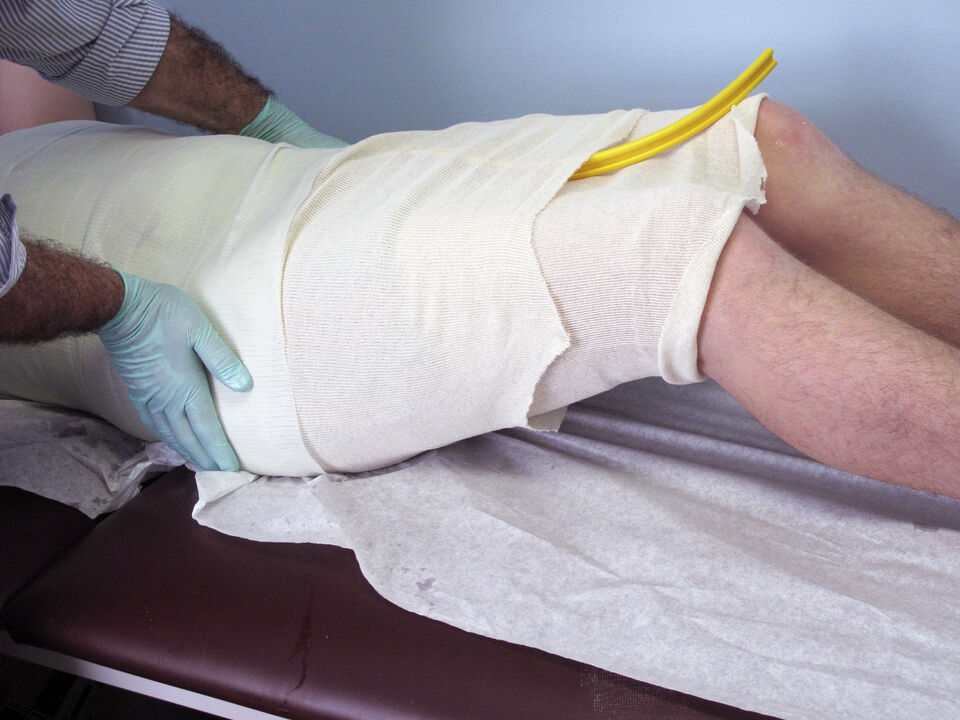 Providence® Orthosis synthetic material casting - Step 3