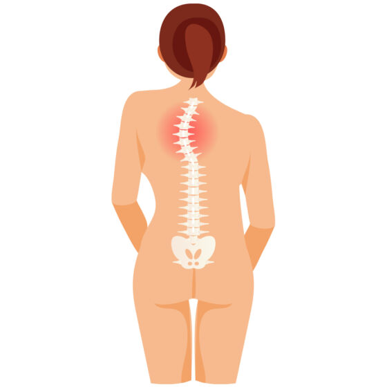 Thoracic Scoliosis
