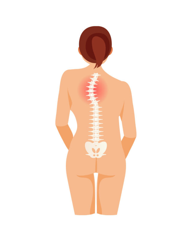 Thoracic Scoliosis