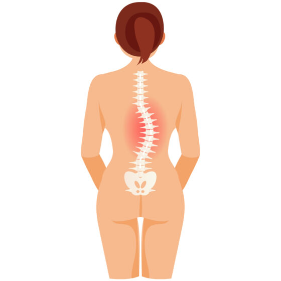 Thoracolumbar Scoliosis