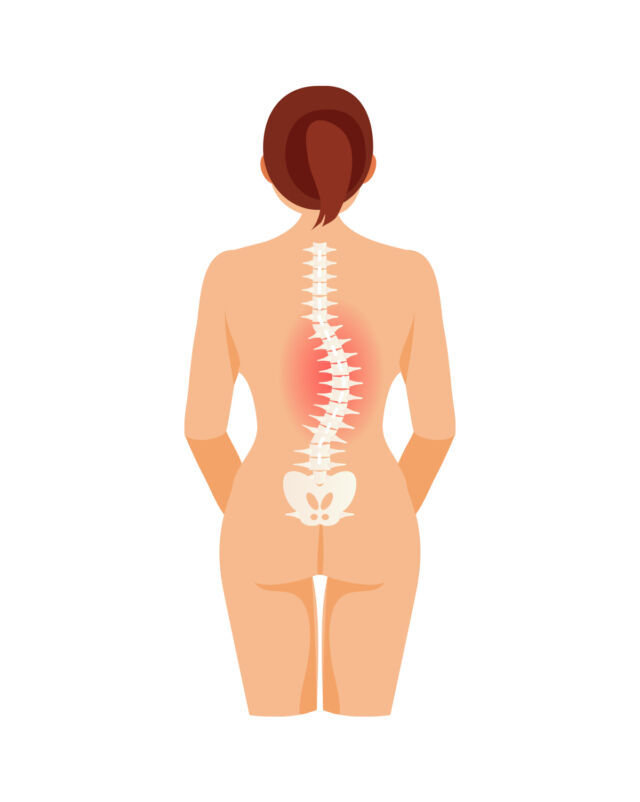 Thoracolumbar Scoliosis