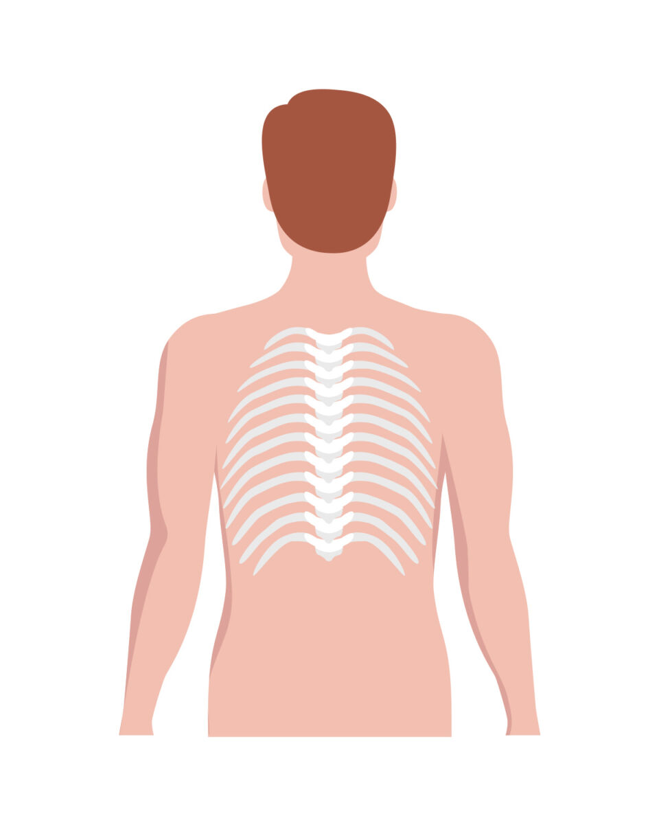 Spinal Technology Types Of Scoliosis