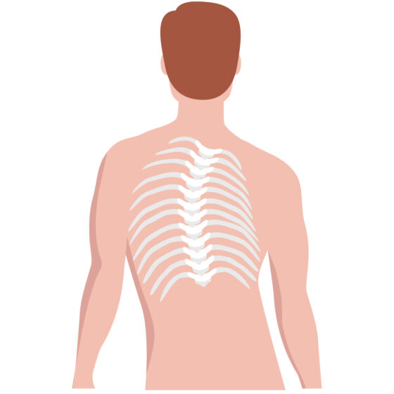 Scoliosis Rib Rotation