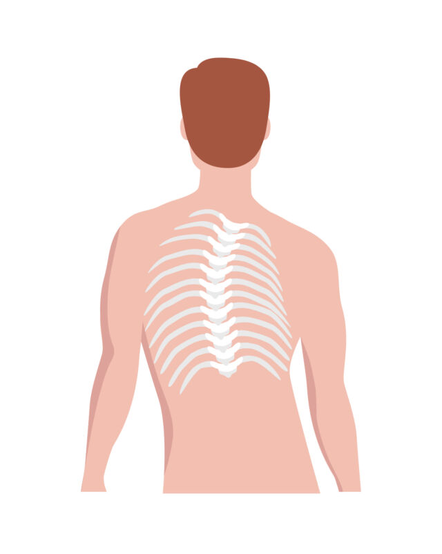 Scoliosis Rib Rotation