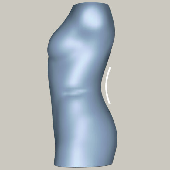 Lordosis