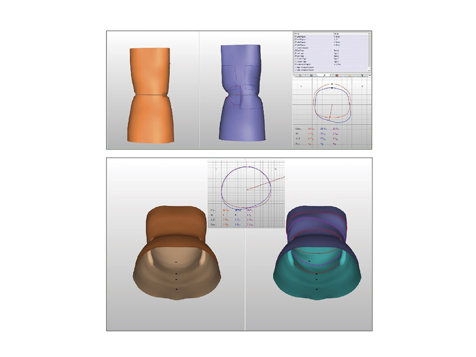 Torso CAD