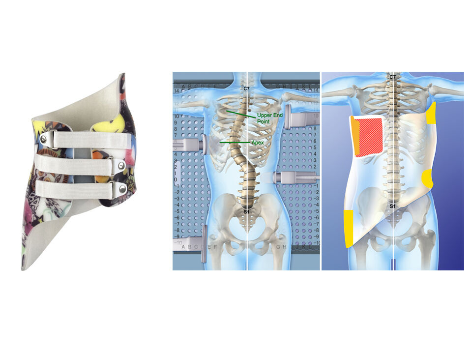 Thoracic Graphic