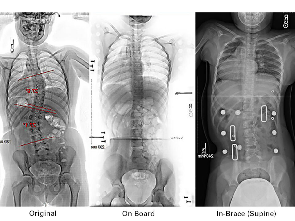 3 Xrays Graphic